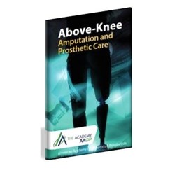 Above-Knee Amputation and Prosthetic Care {English}