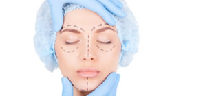 Facial Cosmetic Surgery