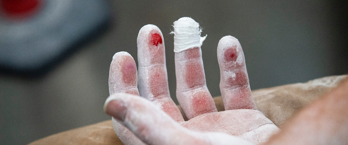 Indoor climbing gym worker with bloody finger