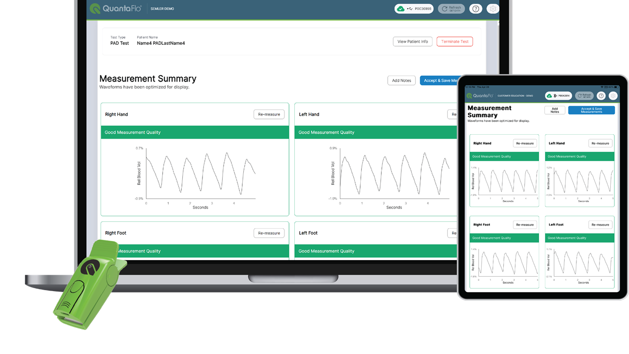 QuanatFlo® device and reusable sensor