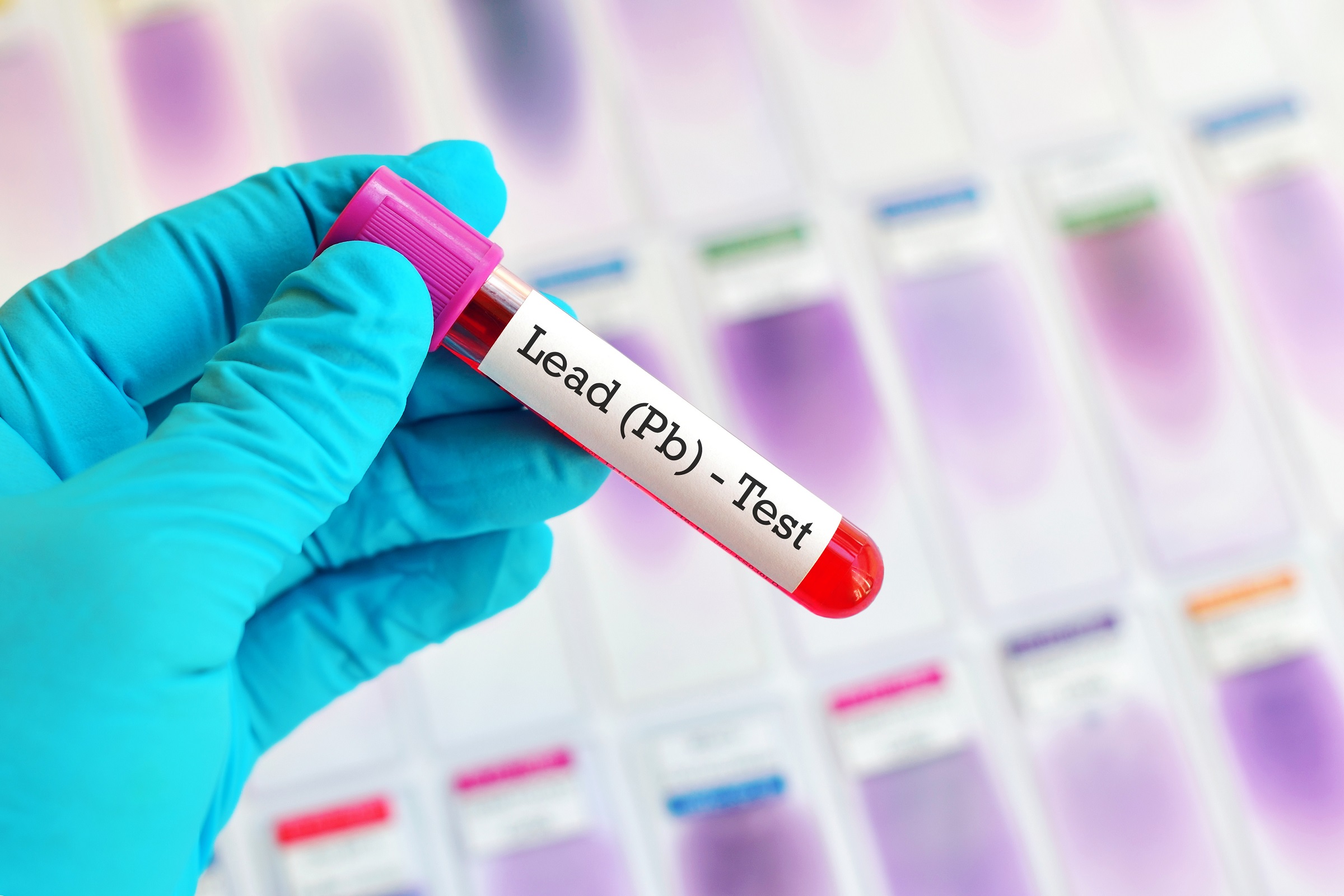 gloved hand holding test tube of blood reading "Lead (Pb)"