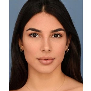 Photo of Adalis Patron